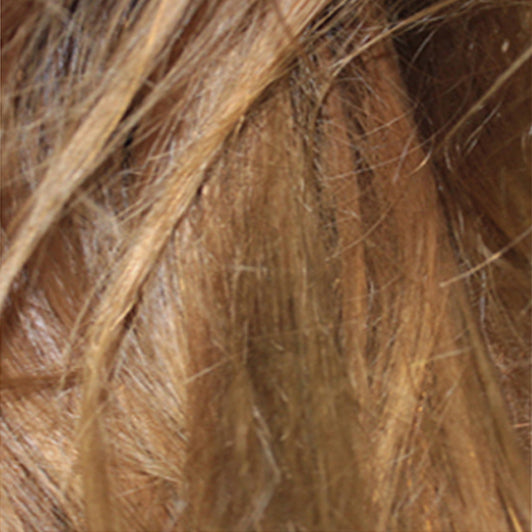 Before treatment