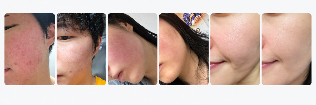 GD11 user photos