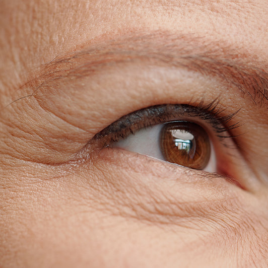 Dehydrated eye contours