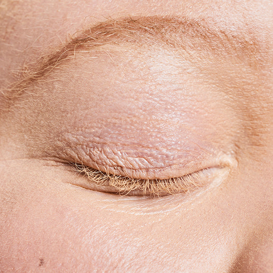 Fragile brow hairs