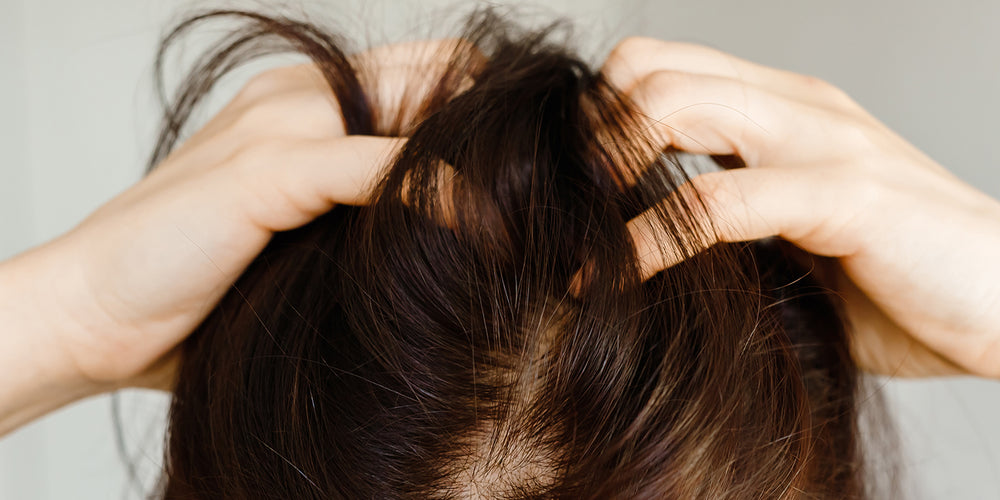 Why does my scalp feel irritated and oily soon after washing?