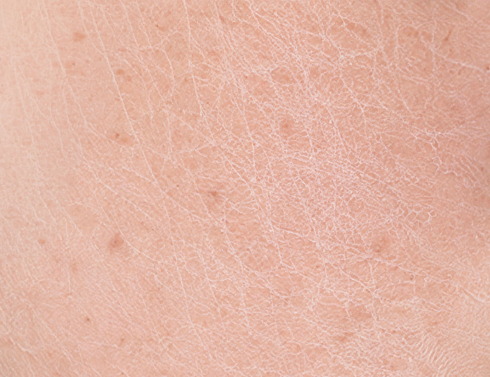 Rough Texture Despite Daily Moisture