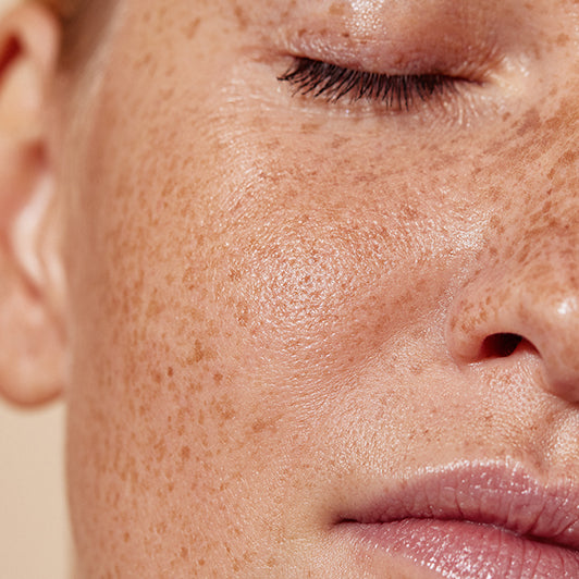 Stubborn dark spots