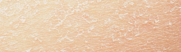 Are your hands prone to dryness and daily external stress?