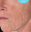 Talika Skintelligence Anti-age Serum before use, showing a close-up of skin with visible wrinkles and fine lines